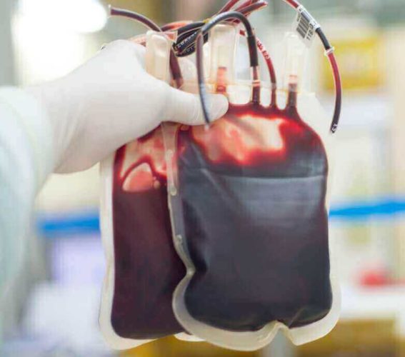 How Cord Blood is Collected